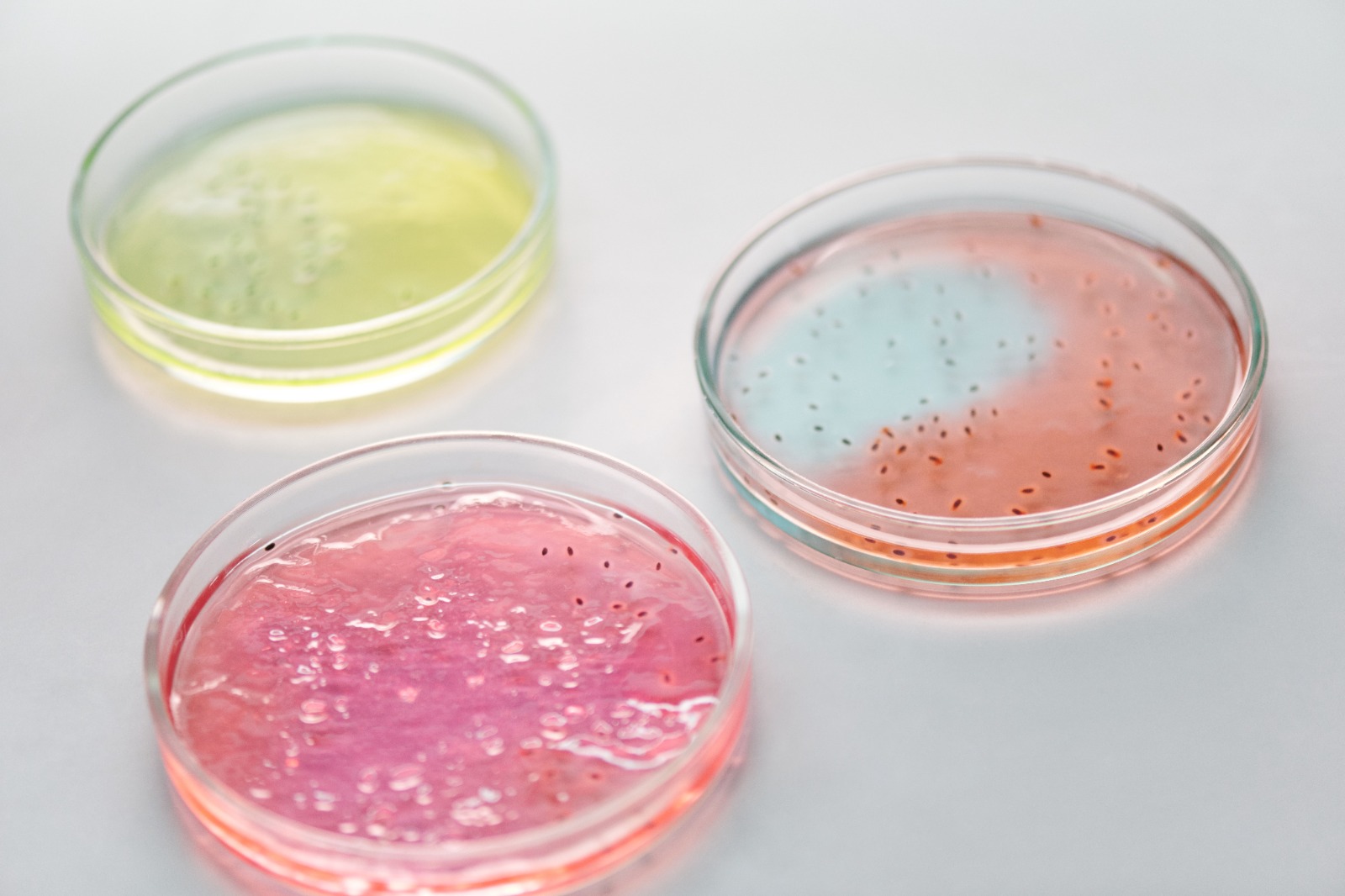 Microbial Media Plates in Lab
